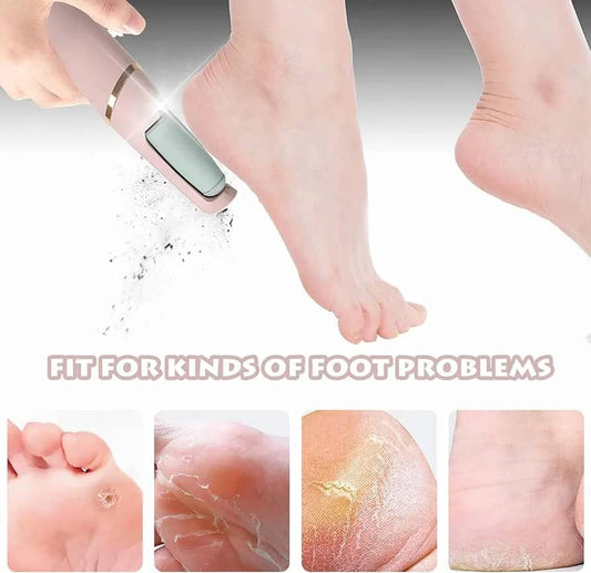 جهاز ازالة الجلد الميت flawless pedi